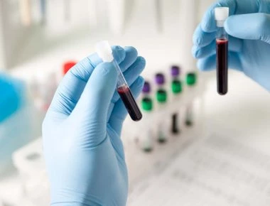 8 διαφορετικά είδη καρκίνου ανιχνεύονται με ένα απλό τεστ αίματος!